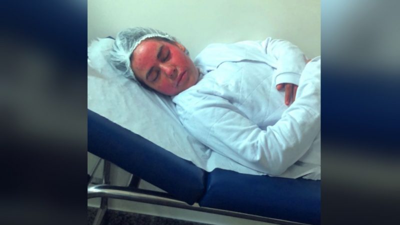 Com fortes dores, estudante que teve 60% do corpo queimado durante experimento em escola volta a ser internada.