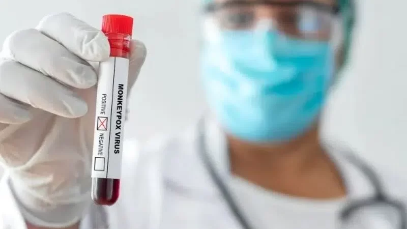 ‘Varíola dos Macacos’ no AM tem transmissão local confirmada pela FVS-RCP